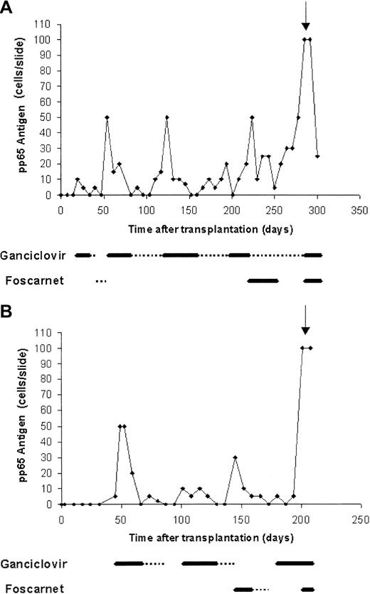 Fig. 1. Recurrent CMV reactivation in patients who developed late-onset CMV disease following preemptive therapy. / (A, patient 1; B, patient 2) Thick line, induction treatment; dotted line, maintenance treatment; arrow, time of diagnosis of disease.