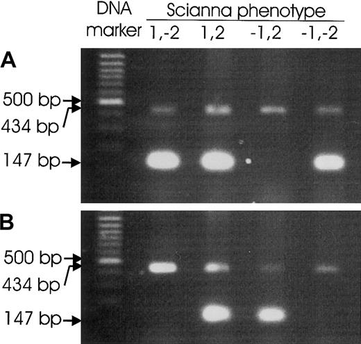 Fig. 2. Scianna genotyping by PCR-SSP. / PCRs were devised to amplify specific PCR products of 147-bp size from the wild-type ERMAP allele representative of Sc1 (A) or from the ERMAP(Gly57Arg) allele carrying the Sc2 antigen (B), respectively. Representative results for Sc:1,-2; Sc:1,2; Sc:-1,2; and Sc:-1,-2 samples are shown. Control PCR products of 434-bp size occurred in all reactions.
