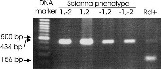 Fig. 3. Radin genotyping by PCR-SSP. / A PCR was devised to amplify a specific PCR product of 156-bp size from the ERMAP(Pro60Ala) allele carrying the Rd antigen. Representative results for Sc:1,-2; Sc:1,2; Sc:-1,2; and Sc:-1,-2 samples and an Rd+ sample are shown. The 434-bp control product derives from the HGH gene, but this product may be lacking because of competition, if a specific product is present.