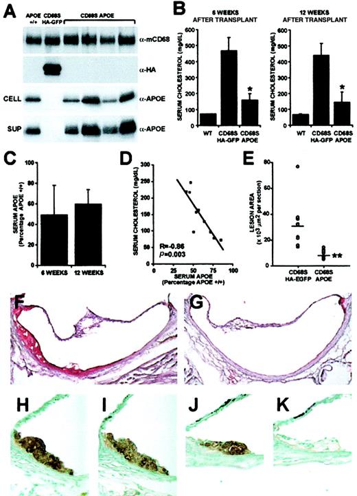 Fig. 5. Gene therapy of ApoE−/− mice using a CD68S retroviral vector. / (A) ApoE expression by thioglycollate-elicited macrophages from wild-type mice (ApoE+/+) orApoE−/− mice that had received transplants of HSCs transduced with either CD68S–HA-EGFP or CD68s-ApoE retroviruses was assessed by immunoblotting of lysates (CELL) or supernatants (SUP) from macrophages cultured ex vivo for 24 hours using an antibody recognizing ApoE (α-ApoE). A similar blot probed with an antibody against macrosialin (α-mCD68) served as loading control, and blotting with an antibody recognizing the HA epitope (α-HA) showed expression of HA-EGFP only in macrophages fromApoE−/− mice that had received transplants of HSCs transduced with CD68S–HA-EGFP retrovirus. (B) Serum cholesterol was measured in samples obtained from bleeds performed 6 and 12 weeks after HSC transplantation. Graphs show the mean serum cholesterol ± SD (n = 10). *P < .0001 as measured by the Mann-Whitney nonparametric test. (C) ApoE levels in sera fromApoE−/− mice that had received transplants of HSCs transduced with CD68S-ApoE retrovirus were measured by densitometric analyses of immunoblots performed with an antibody against ApoE. The graphs show mean ApoE expression ± SD (n = 10) expressed as a percentage of ApoE present in serum from anApoE+/+ control mouse. (D) A plot of serum cholesterol and ApoE values from individual mice reveals an inverse, linear relationship (R = −0.86, p = .003, by Spearman rank correlation test). (E) Quantitative measurement of atherosclerosis in the aortic root inApoE−/− mice 12 weeks after transplantation. Each point (open circle) represents the mean lesional area (μm2 × 103 per section) from an individual mouse. A horizontal line indicates the average lesion area for each group of mice. **P < .0001 as measured by the Mann-Whitney nonparametric test (n = 10). (F-G) Representative Oil Red O–stained sections from the aortic root ofApoE−/− mice that had received transplants of HSCs transduced with CD68S–HA-EGFP (F) or CD68S-ApoE (G) retroviruses. (H-K) Immunohistochemical analysis of similar lesions fromApoE−/− mice that had received transplants of HSCs transduced with CD68S–HA-EGFP (H-I) or CD68S-ApoE (J-K) retroviruses reveals comparable levels of macrophage staining with an antibody recognizing MAC-2 (H,J), but only macrophages in lesions from mice receiving CD68S–HA-EGFP–transduced HSCs show reactivity with an antibody against the HA epitope (I,K). Original magnifications: × 10, F-G; × 40, H-K.