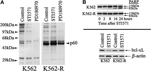 Fig. 4. Effect of STI571 on tyrosine phosphorylation, PARP proteolysis, and bcl-xL expression in K562 and K562-R cells. / (A) K562 (left) or K562-R cells (right) were treated with STI571 or PD180970 (1 μM) for 30 minutes before equal protein cell lysates (30 μg) were analyzed for tyrosine phosphorylation by immunoblotting. (B, top) K562 and K562-R cells were treated with 5 μM STI571 for the interval noted prior to analysis of PARP cleavage by immunoblotting as a measure of activation of caspase cascades. Intact (116 kDa) and cleaved (85 kDa) PARP are shown. (B, bottom) Lysates from untreated (control) and STI571 treated (5 μM, 24 hours) K562 or K562-R cells were analyzed for bcl-xL levels by immunoblotting. Equal protein loads were monitored by probing β-actin on the same membrane.