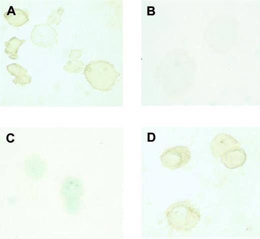 Fig. 1. Expression of embryonic and adult globin in erythroblasts derived from ES cells in vitro. / Immunostaining of εy and β-major globin was described in “Materials and methods.” (A) Incubation of day 8 erythroblasts with rabbit antimouse εy globin. (B) Incubation of day 8 erythroblasts with rabbit antimouse β-major globin. (C) Incubation of day 14 erythroblasts with rabbit antimouse εy globin. (D) Incubation of day 14 erythroblasts with rabbit antimouse β-major globin. Original magnification × 1000.
