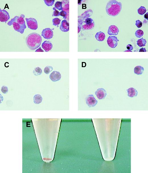 Fig. 2. Morphology of erythroblasts derived from ES cells in vitro. / The wild-type and Alas2-null ES cells were cultured on a feeder layer of OP9 cells, and floating cells on day 8 and day 14 were collected as primitive and definitive erythroblasts, respectively. (A) The wild-type primitive erythroblasts. (B) Alas2-null primitive erythroblasts. (C) The wild-type definitive erythroblasts. (D) Alas2-null definitive erythroblasts. Original magnification, × 400 for panels A-D. (E) Cell pellet of the wild-type (left, red) and Alas2-null (right, white) definitive erythroblasts.