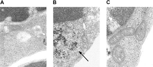Fig. 3. Electron microscopic analysis of. / Alas2-null definitive erythroblasts. The wild-type and Alas2-null definitive erythroblasts were examined by TEM. (A) The wild-type definitive erythroblasts. (B)Alas2-null definitive erythroblasts (ferritin aggregates indicated by an arrow). (C) Alas2-null definitive erythroblasts (no iron granules in mitochondria). The original magnification was × 50 000 for all panels.