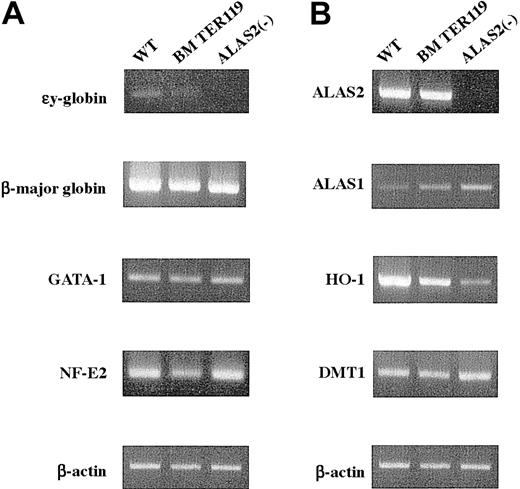 Fig. 4. Expression of erythroid-specific genes and genes involved in heme biosynthesis and catabolism. / Total RNA was extracted from the wild-type and Alas2-null definitive erythroblasts or TER119+ bone marrow erythroid cells, and 2 μg total RNA was reverse transcribed. Then, target genes were amplified by PCR with a set of specific primers using 1 μL cDNA solution as a template. (A) Erythroid-specific genes. (B) Genes involved in heme biosynthesis, catabolism, and iron metabolism. Although the Alas2 gene is both an erythroid-specific and a heme pathway gene, its expression is shown in panel B.