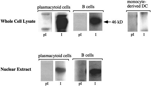 Fig. 2. pDCs express Spi-B at the protein level. / Western blot analysis of Spi-B protein from pDCs. Cytoplasmic or nuclear protein extracts were prepared from pDCs as indicated in “Materials and methods.” The extracts were separated by SDS-PAGE and analyzed by Western blotting using preimmune sera (pI) and anti–Spi-B sera (I). Blots were visualized by chemoluminescence. The size of molecular mass standard is indicated on the right. Tonsillar B cells were used as positive controls.