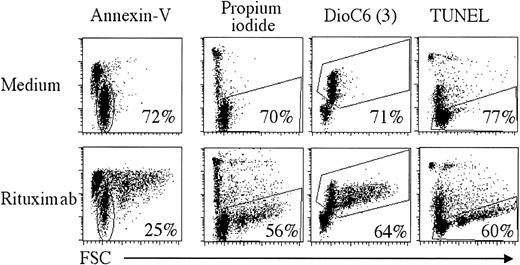 Fig. 2. Detection of rituximab-induced apoptosis. / B cells from patient FL3 were incubated in medium alone (upper panels) or with 2 μg/mL rituximab (lower panels) for 2 days. Cell death was analyzed using annexin V, PI, DiOC6(3), or the TUNEL assay. Percentages of gated cells are indicated.