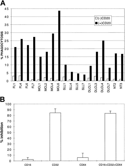 Fig. 3. Rituximab-mediated phagocytosis. / (A) Lymphoma cells (4 MCLs, 4 DLCLs, 4 FLs, 4 SLLs) and 2 NTs were opsonized (black bars) or not (empty bars) by 2 μg/mL rituximab, washed, and incubated with macrophages in RPMI 10% human serum for 2 hours. Phagocytosis is represented as the percentage of phagocytosing macrophages. (B) Inhibition represents pooled data (mean inhibition ± SD) from experiments with FL7, MCL6, NT3 and the same source of macrophages as in panel A, with anti-CD16, anti-CD32, anti-CD64 alone or in combination (CD16 + CD32 + CD64).
