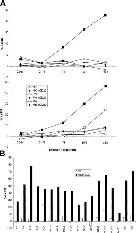 Fig. 4. ADCC. / (A) Lymphoma cells (MCL6 in upper panel, MCL1 in lower panel) were incubated at different ratios with NK cells (squares), polynuclear leukocytes (triangles), or monocytes (circles) in the presence (closed symbols) or absence (open symbols) of 2 μg/mL rituximab. Cytotoxicity was determined by chromium release and is represented as the percentage of specific lysis of tumor cells. (B) NK cell–mediated lysis of lymphoma cells (4 MCLs, 4 DLCLs, 4FLs, 4 SLLs) and 2 NTs, in presence (NK + CD20) or absence (NK) of rituximab at the 25:1 (E/T) ratio.