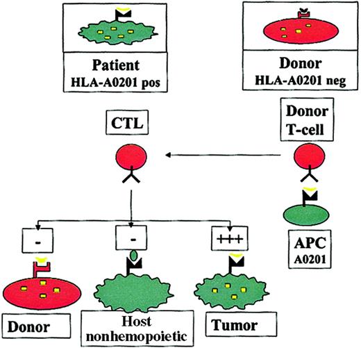 Fig. 1. The allorestricted cytotoxic T-cell concept. / Hematopoietic cells from an HLA-A0201+ patient present a hematopoietic epitope (eg, a CD45-derived peptide), represented by the yellow tick, on surface HLA-A0201 molecules. Because of tolerance, T cells recognizing this self-peptide have been clonally deleted in the patient. In contrast, in an HLA-A0201−donor who shares this antigen, the epitope cannot be presented because of the lack of HLA-A0201 on the cells; consequently T cells directed against this epitope are not deleted. Stimulation of such T cells with HLA-A0201+ APCs pulsed with the epitope may generate allorestricted CTLs that recognize leukemic and normal host hematopoietic cells, which coexpress HLA-A0201 and the hematopoietic antigen, but that do not recognize host nonhematopoietic tissues, which do not express the antigen or donor hematopoietic cells from the graft and are HLA-A0201−.