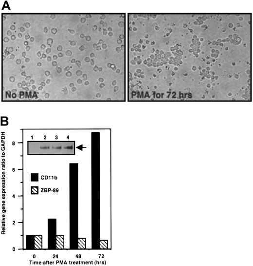 Fig. 5. Expression profiles of endogenous ZBP-89 protein and mRNA and CD11b mRNA during differentiation of U937. / (A) Morphology of U937 cells without (left panel) and with PMA treatment for 72 hours (right panel). The later cells form readily visible clusters (original magnification, × 40). (B) Real-time RT-PCR analysis of CD11b and ZBP-89 during U937 cell differentiation. The experiment was performed using total RNA isolated from U937 cells treated with PMA (100 ng/mL) for 0, 24, 48, and 72 hours. The ratios CD11b/GAPDH or ZBP-89/GAPDH in untreated U937 cells (0 h) were given a value of 1, and the ratios at 24, 48, and 72 hours are displayed as fold above 1. (Inset) Thirty micrograms of nuclear extract from U937 cells treated with PMA (100 ng/mL) for 0 (lane 1), 24 hours (lane 2), 48 hours (lane 3), and 72 hours (lane 4) were resolved by 6% SDS-PAGE. Proteins were transferred to a nitrocellulose membrane and analyzed with an anti–ZBP-89 antibody followed by chemiluminescence. ZBP-89 protein is indicated with an arrow.