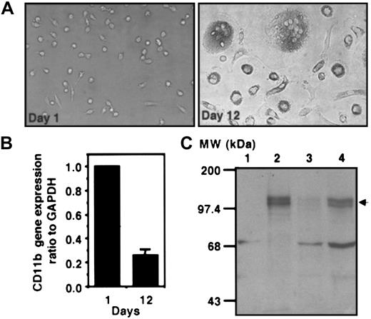 Fig. 6. Inverse correlation between endogenous ZBP-89 protein and CD11b mRNA during differentiation of monocytes/macrophages. / (A) Morphology of human monocytes during differentiation and maturation into macrophages is shown at day 1 (left panel) and day 12 (right panel). Representative fields are shown using light microscopy (original magnification, × 40). (B) Real-time RT-PCR analysis ofCD11b during monocyte/macrophage differentiation. Total RNA isolated from monocytes/macrophages differentiated in vitro for 1 or 12 days were reverse transcribed to make cDNA. Quantitative PCR was carried out using the TaqMan system and an ABI Prism 7700 instrument as described in “Materials and methods.” The copy number of CD11b is normalized to the copy number of GAPDH and expressed as CD11b/GAPDH. The CD11b/GAPDH ratio in monocytes at day 1 was given a value of 1, and the ratio at day 12 is shown as a relative value to 1. Each histogram represents the mean ± SD of 3 independent experiments. (C) Western blot analysis showing ZBP-89 protein expression during differentiation of U937 cells and monocytes/macrophages. Five micrograms of nuclear extract from U937 cells treated with PMA for 0 hours (lane 1) or 72 hours (lane 2), and 30 μg total protein lysate from monocytes/macrophages differentiated for 1 (lane 3) or 12 days (lane 4) were resolved by 6% SDS-PAGE. Proteins were transferred to a nitrocellulose membrane and detected with an anti–ZBP-89 antibody followed by chemiluminescence. ZBP-89 (arrow) migrates as a double band with apparent mobility of about 120 kDa, consistent with similar analyses by other investigators303460 MW indicates molecular weight markers (Gibco-BRL).