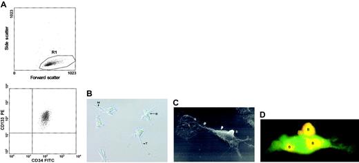 Fig. 1. Morphologic characterization of adherent cells. / (A) CD133+ cells mobilized from peripheral blood were enriched by MACS. Flow cytometry showed that the purity of the positively selected CD133+ cells was generally greater than 99.5%. (B) Inverse microscopic image of typical 6-week-old adherent cells (original magnification, × 200). B indicates bud; M, magnupodium; T, tenupodium. (C) Raster electron micrograph of a 6-week-old adherent cell (original magnification, × 2000). B indicates a bud on the cell surface; L, a spoonlike lobopodium at the terminus of the cell (upper left corner of the micrograph). (D) A 6-week-old adherent cell that emerged from a population of EGFP-expressing CD133+ cells is counterstained with PE-conjugated mouse antihuman CD133 antibody. Yellow fluorescence caused by the overlay of green (EGFP) and red (CD133) fluorescence indicates double staining of the buds (indicated by B).