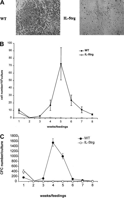 Fig. 1. Hematopoietic activity of IL-5trg bone marrow in vitro. / LTBMCs (n = 3 per group) were established from IL-5trg and WT mice. (A) Photographs of adherent layers from IL-5trg and WT LTBMCs were taken after 4 weeks of culture. Areas of hematopoiesis are evident in WT but not in IL-5trg LTBMCs. Magnification ×10. (B) Half of the culture medium was harvested from LTBMCs after each feeding, and the number of nonadherent cells was calculated and expressed as mean ± SD. (C) Nonadherent cells harvested from IL-5trg and WT LTBMCs were plated at a concentration of 1 × 104 cells/mL in the presence of GM-CSF (10 ng/mL). After 7 days of culture, the number of colonies was counted, recalculated for the total number of nonadherent cells recovered from LTBMCs, and expressed as mean ± SD of the number of CFCs.
