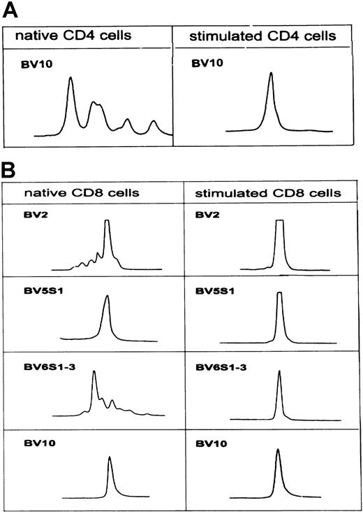 Fig. 3. TCR-BV CDR3 length profile of native CD4 and CD8 T cells and after stimulation with the autologous leukemic B cells in patient CLL402. / See Figure 2A.