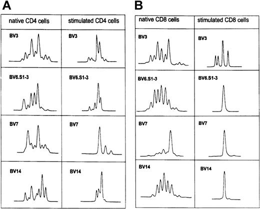 Fig. 5. TCR-BV CDR3 length pattern of native CD4 and CD8 T cells and after stimulation with the autologous leukemic B cells in patient CLL411. / See Figure 2C.
