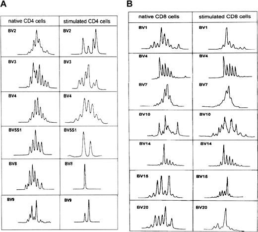 Fig. 6. TCR-BV CDR3 length pattern of native CD4 and CD8 T cells and after stimulation with the autologous leukemic B cells in patient CLL403. / See Figure 2B.