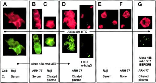 Fig. 3. Alexa 594 RTX and Alexa 488 mAb 3E7 colocalize on Raji and ARH-77 cells only if RTX is bound to the cells in the presence of a C source. / (A-C) Alexa 594 RTX and Alexa 488 mAb 3E7 colocalize on cells opsonized in NHS or in citrated plasma. Cross-linking and capping are evident. (D) After opsonization with RTX in citrated plasma, ARH-77 cells were washed and probed with either Alexa 488 mAb 3E7 or FITC mAb HB43. (E-F) Alexa 594 RTX binds to cells in a homogeneous pattern if mAb 3E7 is omitted (panel E) or if NHS is omitted (panel F), and no cross-linking is observed. (G) When cells are opsonized in citrated plasma with Alexa 488 mAb 3E7, washed, and Alexa 594 RTX added, the probes do not colocalize, but they do colocalize when the order of addition is reversed (panel D). Original magnification × 250.