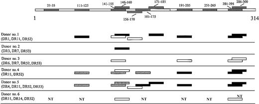 Fig. 1. MAGE-3 sequence segments recognized by CD4+T cells from 6 donors and their HLA-DR type. / Polyclonal CD4+ T-cell lines propagated in culture with pool I and pool II were tested with each single peptides (10 μg/mL) forming the pools in 2-day microproliferation assays. The results are representative of several assays in the case of donors 1, 2, 4, and donor/patient 5 and, at least 2 experiments, in the case of donor 3 and donor/patient 6. Peptides that elicited a strong response are indicated in black (P < .001), peptides that elicited an intermediate response are indicated in hatched segments (.001 < P < .05), and peptides that elicited a low but still significant response are indicated in white (P < .05). Responses significantly higher than the blanks (ie, the basal level of proliferation of CD4+ T cells in the presence of autologous PBMCs as APCs) were determined by unpaired, one-tailed Student t test. NT indicates not tested.