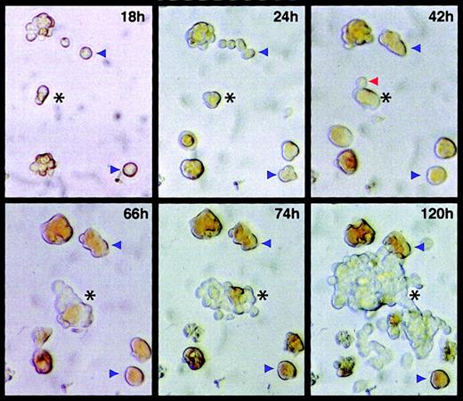 Fig. 3. Temporal sequence of cell transformation by E26 virus. / JS4+ cells were sorted by FACS and, after verifying that they were mostly single, they were infected with E26 virus and seeded in methylcellulose in 35-mm culture dishes that had been pretreated with collagen. After the cells had settled through the semisolid medium, starting at 18 hours after infection, micrographs were taken of the same field (marked on the bottom of the dish) at various intervals. The black asterisks in the frames taken at 18 and 24 hours indicate the cells from which the transformed colony visible in frames 66, 72, and 120 hours emerged. The red arrowhead in the 42-hour frame points to a cell that probably represents the first transformant in the nascent E26 colony. Blue arrowheads denote positions of normal erythroid colonies. Two erythroid “colonies” (seen on the upper and bottom left of the 18-hour frame) represent clusters formed during seeding. Two colonies in the 24-hour time frame appeared to form de novo resulted from cells that settled more slowly through the viscous medium after seeding of the cells in methylcellulose cultures. The same analysis was performed with another E26-transformed colony, with similar results. Original magnification for all panels, × 20.