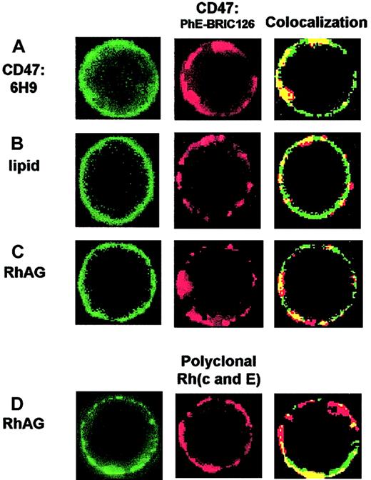 Fig. 2. Colocalization of membrane components to clusters of PhE-BRIC126–labeled CD47 or to polyclonal-labeled Rh. / (A) Positive colocalization: double labeling of CD47 with a noncompeting monoclonal antibody, 6H9. Higher intensity spots of 6H9 (green) generally coincide with the clusters of CD47 produced by PhE-BRIC126 (red). The overlap image shows yellow colocalized regions. (B) Negative colocalization: uniform labeling of the lipid bilayer with fluorescein-phosphatidylethanolamine (FL-PE). Similar images were obtained with antibody labeling of Band 3 as well as glycophorin C, as quantified in Figure 3. (C) Yellow spots in the colocalization image indicate significant overlap of antibody-labeled RhAG (green) with PhE-BRIC126 (red). (D) A polyclonal antibody against Rh(c and E) also generates clusters to which RhAG colocalizes.