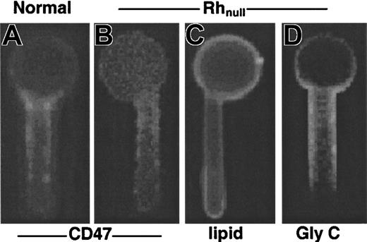 Fig. 5. Fluorescence images of CD47, lipid, and glycophorin C on normal and Rhnull-aspirated erythrocytes. / (A) FIMD of CD47-labeled cells (using TRITC-BRIC126 Fab) shows gradient from entrance to cap, indicative of considerable cytoskeletal attachment. (B) FIMD of CD47-labeled Rhnull cells (using TRITC-BRIC126 Fab) shows similar cytoskeletal attachment. (C) FIMD of lipid bilayer–labeled Rhnull cells illustrates the absence of any significant gradient, consistent with a homogeneous fluid bilayer. (D) FIMD of glycophorin C–labeled Rhnull cells illustrates the strong entrance to cap gradient, consistent with a cytoskeletally linked protein.