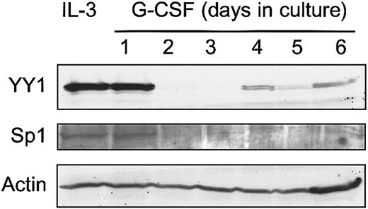 Fig. 3. Western blot analysis of YY1 expression in 32D-WT1 cells. / G-CSF responsive 32D-WT1 cells were cultured in IL-3–containing medium and then switched to G-CSF. Samples were taken daily and processed as described in “Materials and methods.” The blot was hybridized with anti-YY1 or anti-Sp1, stripped, and rehybridized with anti-Actin to check for equal loading of cell lysates.