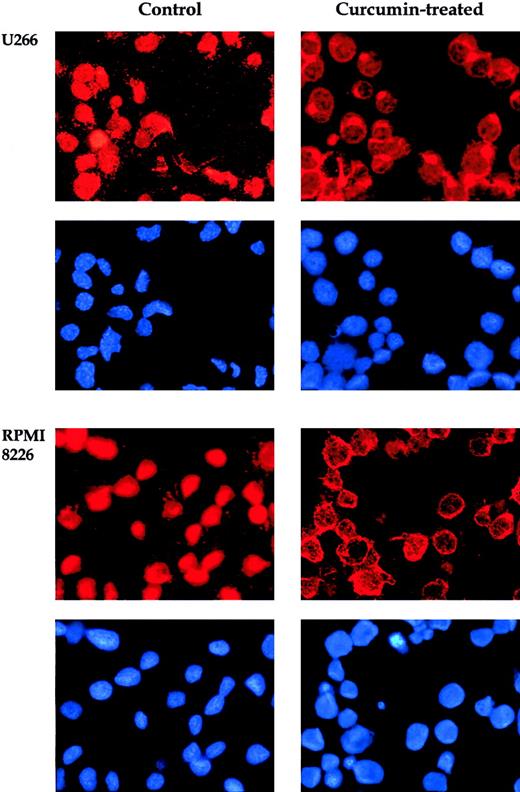 Fig. 2. Effect of curcumin on p65. / Curcumin induces redistribution of p65. U266 and RPMI 8226 cells were incubated alone or with curcumin (50 μM) for 4 hours and then analyzed for the distribution of p65 by immunocytochemistry. Red stain indicates the localization of p65, and blue stain indicates nucleus. Original magnification, × 200).