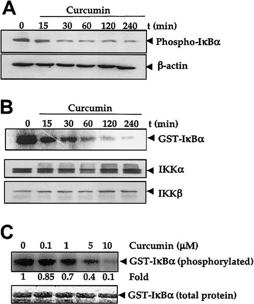 Fig. 3. Effect of curcumin on IκBα phosphorylation and IκB kinase. / Curcumin inhibits IκBα phosphoryalation and IκB kinase. (A-B) First, 5 × 106 U266 cells per 2.5 mL were treated with curcumin (50 μM) for the indicated times. Cytoplasmic extracts were prepared for checking the level of phosphorylated IκBα by Western blotting (panel A), or IKK was immunoprecipitated and the kinase assay was performed (panel B) to check the IKK activity (upper panel), or Western blotting was performed for the analysis of total IKKα and IKKβ proteins in cytoplasmic extracts (lower panel). (C) Cytoplasmic extracts were prepared from 5 × 106 U266 cells, IKK was immunoprecipitated, and kinase assay was performed in the absence or presence of the indicated concentration of curcumin (upper panel). Lower panel indicates the amount of glutathione S–transferase (GST)–IκBα protein stained with Coomassie blue in each well in the same dried gel.
