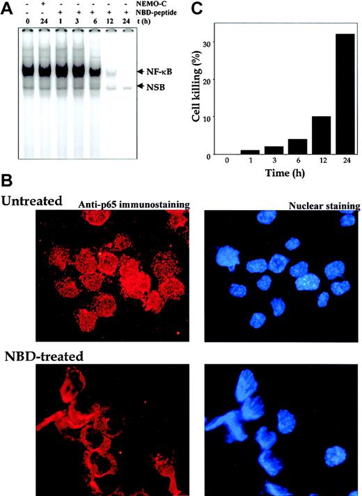 Fig. 9. Effect of NBD peptide on human multiple myeloma cells. / NEMO-binding domain (NBD) peptide inhibits constitutive NF-κB and induces cytotoxicity in human multiple myeloma cells. (A) U266 cells (2 × 106/mL) were treated with the indicated concentrations of NEMO control or NBD peptide (100 μM) for the indicated times. Nuclear extracts were checked for the presence of NF-κB DNA-binding activity by EMSA. (B) Untreated or NBD peptide–treated (100 μM; 12 hours) U266 cells were cytospun, and p65 immunocytochemistry was performed as described in “Materials and methods.” Red stain indicates the localization of p65, and blue stain indicates nucleus. Original magnification, × 200). (C) U266 cells (2 × 106/mL) were treated with the indicated concentrations of NEMO control or NBD peptide (100 μM) for the indicated times, and cell viability was monitored by the trypan blue dye-exclusion method. The percentage of cell killing was determined as follows: Percentage killing = (number of trypan blue stained cells/total cells) × 100.