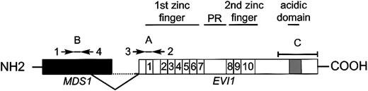Fig. 1. Schematic representation of EVI1 andMDS1-EVI1 and the primer and probes used for real-time PCR. / Primers 1 and 2 plus probe A were used to determineMDS1-EVI1 expression levels. EVI1transcript levels were determined using primers 3 and 2 plus probe A.MDS1 expression was measured using primers 1 and 4 plus probe B. Probe C was used for Northern blot analysis.