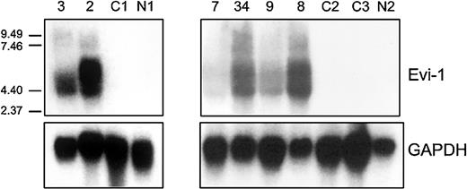 Fig. 2. EVI1 mRNA expression in AML samples as determined by Northern blotting. / Human 600-bp HindIII-Ncol EVI1 probe (see Figure 1) was used, which does not discriminate betweenEVI1 and MDS1-EVI1. Murine GAPDH fragment was used as control. Patients 2, 3, and 7 carry a 3q26 abnormality (Table 3); patients 8, 9, and 34 have high EVI1expression but no 3q26 abnormality (Table 4). C1, C2, C3 represent AML patients without EVI1 expression. N1 and N2 represent normal bone marrow samples.