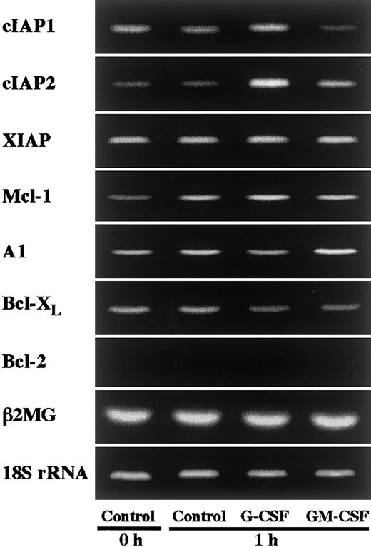 Fig. 1. Effects of G-CSF and GM-CSF on expression of apoptosis-related gene transcripts in neutrophils. / Neutrophils were cultivated in the presence or absence of G-CSF (50 ng/mL) or GM-CSF (5 ng/mL) for 1 hour, and thereafter the expression of cIAP1, cIAP2, XIAP, Mcl-1, A1, Bcl-XL, and Bcl-2 mRNA was analyzed by semiquantitative RT-PCR. As internal controls, β2-microglobulin (β2MG) and 18S rRNA were used. The results shown are representative of 3 independent experiments.