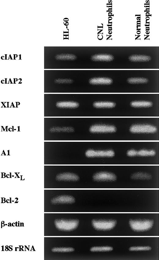 Fig. 8. Expression of apoptosis-related gene transcripts in CNL neutrophils. / The expression of cIAP1, cIAP2, XIAP, Mcl-1, A1, Bcl-XL, and Bcl-2 mRNA in HL-60 cells, CNL neutrophils, and normal neutrophils was analyzed by semiquantitative RT-PCR. As internal controls, β-actin and 18S rRNA were used. The results shown are representative of 3 independent experiments.