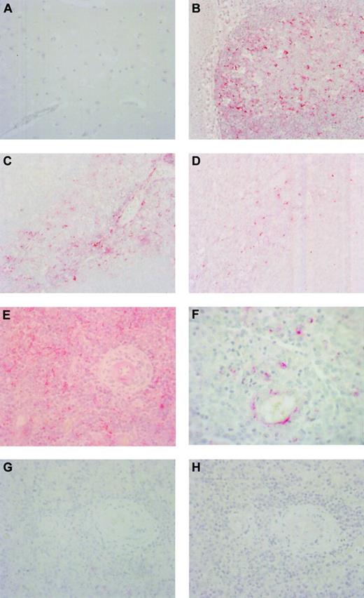 Fig. 2. BCA-1 expression in tonsil, brain, and PCNSL. / Immunohistochemical studies demonstrate that BCA-1 is not present in normal human brain (A) but is expressed in lymphoid follicles of tonsil (B) (Fast Red, hematoxylin counterstain, original magnification × 400). In tonsil, expression of SLC (C) and ELC (D) is localized to T-cell areas (Fast Red, hematoxylin counterstain, original magnification × 400). Brain biopsy specimen from a patient with PCNSL reveals widespread expression of BCA-1 (E), but not SLC (G) or ELC (H) within the tumor substance (Fast Red, hematoxylin counterstain, original magnification × 400). (F) Location of positive staining suggests that BCA-1 is expressed by malignant B cells and vascular endothelium (Fast Red, hematoxylin counterstain, original magnification × 1000).