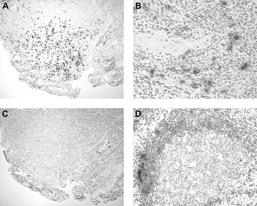 Fig. 5. BCA-1 mRNA expression in PCNSL. / In situ hybridization confirms BCA-1 expression in brain biopsy specimen from a patient with PCNSL. Antisense (A) and sense (C) hybridizations are shown (hematoxylin counterstain, original magnification × 40). (B) Vascular endothelium does not appear to synthesize BCA-1 because BCA-1 mRNA is localized solely to B lymphocytes (hematoxylin counterstain, original magnification × 200). (D) In human tonsil, BCA-1 mRNA is present in the lymphoid follicles (hematoxylin counterstain, original magnification × 200).