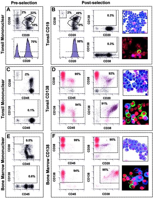 Fig. 1. Cell analyses of representative normal samples before and after immunomagnetic bead enrichment. / 2-color dot plots or histogram plot of FACS analysis of the tonsil mononuclear fractions prior to CD19 selection (A), tonsil mononuclear fractions prior to CD138 selection (C), and bone marrow mononuclear cells prior to CD138 selection (E). 2-color dot plots or histogram plot of dual antibody FACS analysis of cell surface phenotype, light microscopy of morphology, and immunofluoresence microscopy of cytoplasmic immunoglobulin light chain expression in CD19-enriched tonsil BCs (B), CD138-enriched tonsil PC (D), and CD138-enriched bone marrow PCs (F). Antibodies used in individual FACS analyses are indicated to the left and bottom of each FACS plot. The percentage of cells in each gate window is indicated. Original magnification, × 60. Stains are described in “Materials and methods.”