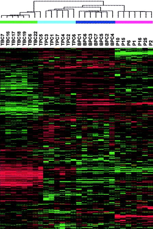Fig. 2. A 2-dimensional hierarchical cluster analysis of 7 tonsil BC (TBC), 7 tonsil PC (TPC), 7 bone marrow PC (BPC), and 7 MM PC samples clustered based on the correlation of experimental expression profiles of 3288 probe sets. / The clustering is presented graphically as a colored image. Along the vertical axis, the analyzed genes are arranged as ordered by the clustering algorithm. The genes with the most similar patterns of expression are adjacent to each other. Experimental samples are arranged the same way along the horizontal axis; those with the most similar patterns of expression across all genes are adjacent to each other. Sample groupings can be further described by following the solid lines (branches) that connect the individual components with the larger groups. The color of each cell in the tabular image represents the expression level of each gene, with red representing an expression greater than the mean, green representing an expression less than the mean, and the deeper color intensity representing a greater magnitude of deviation from the mean.