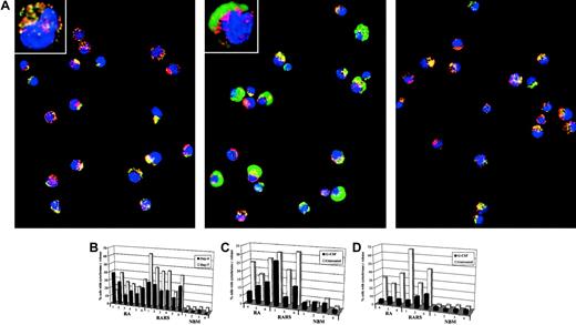 Fig. 1. Spontaneous mitochondrial release of cytochrome. / c in MDS progenitors: inhibition by G-CSF. (A) Mitochondria were stained with MitoTracker (red fluorescence), and cytochrome c localization was revealed by indirect immunofluorescence (green fluorescence). The punctate yellow pattern denotes mitochondrial localization of cytochrome c, and the diffuse green pattern indicates cytochrome c that has been released into the cytosol. Data are derived from normal bone marrow (NBM; left panel), RARS progenitors (middle panel), and RARS progenitors incubated in the presence of G-CSF (100 ng/mL; right panel), at day 7 of culture. Original magnification × 40; insets, × 100. (B) Release of cytochrome c from mitochondria of erythroid progenitors at day 4 and day 7, as determined by digital confocal microscopy. For each position, 500 nucleated cells were counted and each bar represents a single patient. Samples were obtained from patients with RA and patients with RARS, respectively, as well as from NBM. Each group could be further subdivided according to the new World Health Organization (WHO) classification. Hence, there were 2 patients with RA, one of whom carried the 5q− aberration, 4 patients with RCMD, 3 of whom had the 5q− aberration, 4 patients with RARS, and 2 with RCMD-RS. (C) Cytochrome c release in CD34+ (day 4) erythroid precursors incubated in the presence or absence of G-CSF (100 ng/mL). (D) Experimental procedure same as in panel C, for CD36+ (day 7) erythroid progenitors.