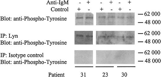 Fig. 3. Identification of Lyn. / CLL samples were incubated with anti-IgM or control antibody for 2 minutes. Samples were either immunoblotted for tyrosine phosphorylation (top panels), or immunoprecipitated (IP) with rabbit anti-Lyn antibody and immunoblotted for tyrosine phosphorylation (middle panels), or immunoprecipitated with rabbit isotype control antibody and immunoblotted for tyrosine phosphorylation (bottom panels). Proteins were separated on a 4% to 15% gradient SDS-PAGE gel. The molecular mass of protein standards is shown.