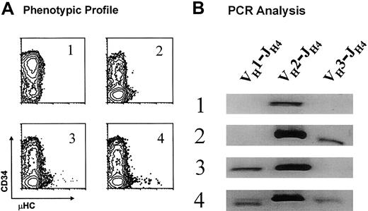 Fig. 7. Analysis of VH gene use in EU12 subclones. / (A) 4 EU12 subclones derived from sorted single cells with pro-B phenotype were selected on the basis of their phenotypic profiles after 10 weeks in culture. (B) gDNA was isolated and used as template for PCR reactions as described for single-cell PCR analysis. The PCR products were subjected to electrophoresis and revealed with ethidium bromide staining.
