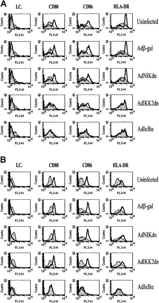 Fig. 6. Expression of IKK2dn blocks CD40L-induced up-regulation of MHC antigen-presenting and costimulatory molecules. / Immature DCs were left uninfected or infected with Adβ-gal, AdNIKdn, AdIKK2dn, and AdIκBα. After culture for 2 additional days, DCs were stimulated for 48 hours with 30 μg/mL of sCD40L (A) or 100 ng/mL LPS (B) and then examined for the expression of CD80, CD86, and HLA-DR by FACS staining. Unstimulated DCs (filled histogram) were compared with sCD40L or LPS-stimulated DCs (open histogram) treated with isotype control (IC), CD80, CD86, and HLA-DR directly conjugated monoclonal antibodies. The results of 1 experiment representative of 3 independent experiments performed on samples from unrelated donors are shown.