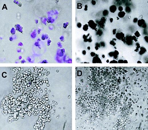 Fig. 2. Methylcellulose colonies from β-globin ECFP mouse bone marrow. / (A,C) Overlay between fluorescence and brightfield images. (B,D) Brightfield images of the same colonies after benzidine staining, with positive cells shown in black. The colony shown in panels A and B is erythroid, and the one in C and D is myeloid. Some cells or clusters within the colonies have shifted position after staining with benzidine. Original magnification, × 10.