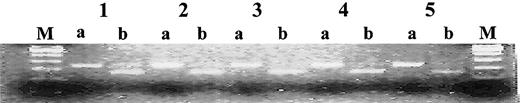 Fig. 2. Restriction digest of the PCR products. / Normal testis (lane 1), AML (lane 2), CML (lane 3), CLL (lane 4), and MM (lane 5) with BglI enzyme showing the specificity of the PCR products. M indicates molecular marker; a, mock digestion; and b,BglI digestion.