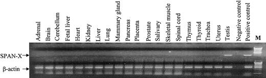 Fig. 3. RT-PCR analysis. / Analysis of RNA from a panel of normal tissue showing SPAN-Xb transcripts in only normal testis.