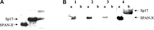 Fig. 6. Western blot analysis to determine the specificity of the anti–SPAN-Xb antibodies. / (A) Coomassie blue staining of a 12% SDS-polyacrylamide gel showing the loading of SPAN-Xb recombinant protein and a control recombinant protein Sp17 (M indicates protein marker; lane a, SPAN-Xb; and lane b, Sp17). (B) Western blot analysis using diluted sera (1:1000) showing the presence of antibodies directed at SPAN-Xb and not Sp17 in patients with hematologic malignancies. Lane 1 indicates serum from patient with CML; lane 2, serum from patient with CLL; lane 3, serum from patient with AML; and lane 4, anti–6-His tag monoclonal antibodies. (Lane a, SPAN-Xb recombinant protein; lane b, Sp17 recombinant protein.)