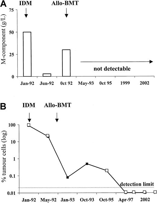 Fig. 1. Longitudinal measurement of disease activity in a MM patient with del13. / The patient presented with a combination a unfavorable prognostic features including del13. After allogeneic bone marrow transplantation performed during relapse, he went into sustained clinical (A) and molecular (B) remission. Remarkable residual MM cells were detected by quantitative PCR more than 3 years after disappearance of myeloma proteins (B).