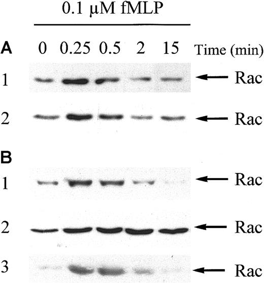 Fig. 2. Rac2 is activated in response to fMLP in neutrophils from healthy volunteers and MDS patients. / Neutrophils were stimulated with 0.1 μM fMLP for the indicated time. Stimulation was stopped by the addition of 3 × lysis buffer. Activated Rac2 was precipitated using GST-PAKcrib protein precoupled to glutathione-Sepharose beads. Proteins were separated by 15% SDS-PAGE and membranes were probed with Rac antibodies, followed by enhanced chemiluminescence. Rac activation was investigated in neutrophils from 8 MDS patients and 8 healthy controls. (A) Two representative blots from healthy subjects. (B) Three representative blots from MDS patients. Equal amounts of glutathione-Sepharose beads were loaded in all samples, as determined by Ponceau S staining of the membranes (not shown).