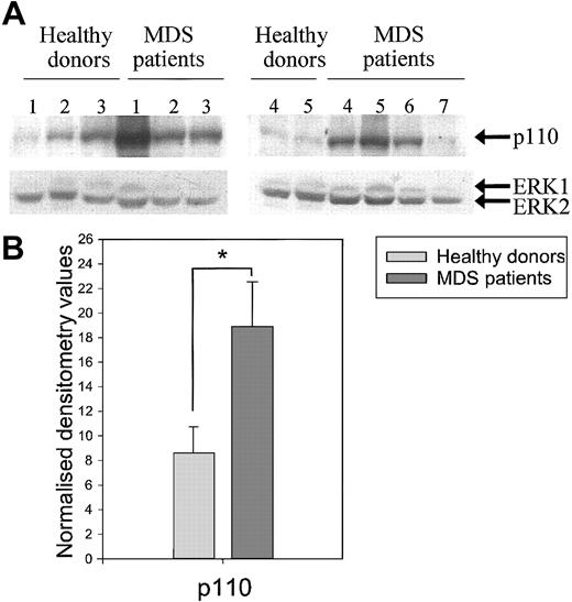 Fig. 8. Increased PI3-kinase subunit p110 protein levels in neutrophils from MDS patients. / (A) Neutrophils from healthy donors (n = 5) and MDS patients (n = 7) were resuspended in 1 × Laemmli, and samples were boiled. Proteins were separated by SDS-PAGE, and Western blotting was performed using an antibody against PI3-kinase p110 (upper panel). Equal loading was demonstrated by reprobing the blots with an antibody against ERK1/2 (lower panel). (B) Protein levels were quantified by densitometry of the films. The p110 protein levels were corrected for ERK levels, and differences between the means of the normalized values were calculated between MDS neutrophils and healthy donors using the Studentt test for unpaired samples. Significant differences are indicated with an asterisk (P < .05).
