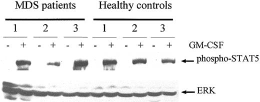Fig. 10. GM-CSF stimulates STAT5 activation in neutrophils from MDS patients and healthy controls to a similar extent. / Cell lysates from unstimulated neutrophils (−) and neutrophils that were stimulated for 10 minutes with 5 ng/mL GM-CSF (+) were analyzed for 3 MDS patients and 3 healthy volunteers. Western blot analysis was performed, and proteins were detected using an antibody against phosphorylated STAT5 (upper panel). Equal loading was confirmed by reprobing the blot with antibodies against ERK1/2.